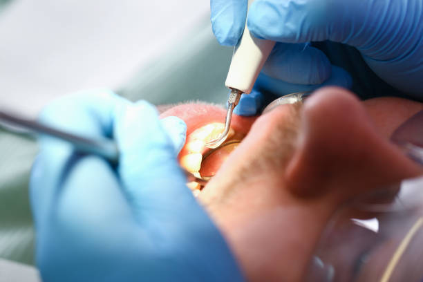 Best 24-Hour Emergency Dentist in Rogers, TX