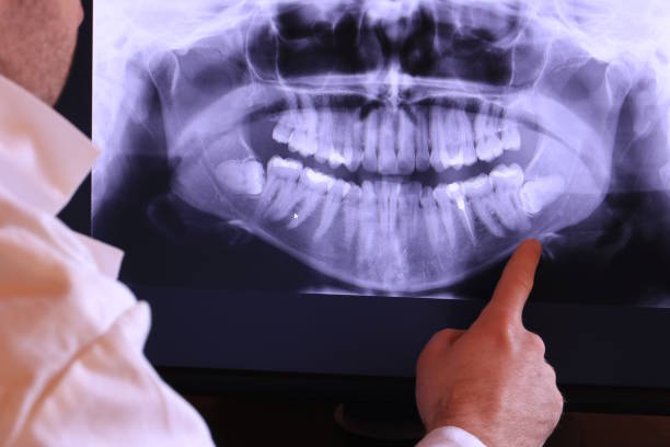 Best After-Hours Emergency Dentist in Rogers, TX